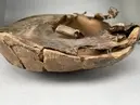 Skåltrumma