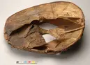 Skåltrumma