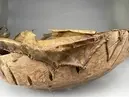 Skåltrumma